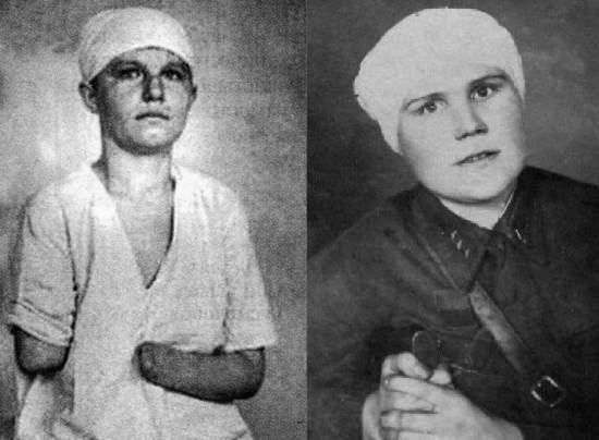 В 22 осталась без рук, без ног, вся в шрамах. Боец зарыдал и бросился перед ней на колени: «Прости, сестренка, прости меня» (2020)